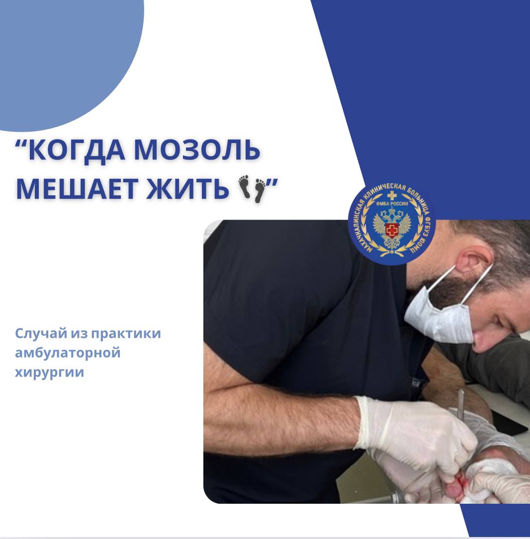 Когда мозоль мешает жить